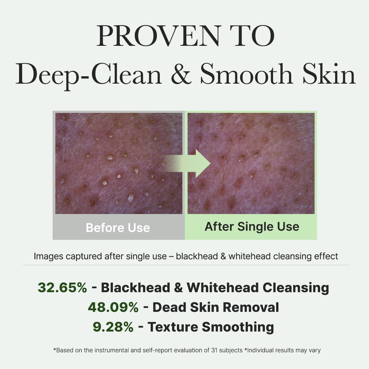 Korean Rice Mochi Face Cleanser - Face Wash, Gentle Scrub All in One for Deep Cleansing, Moisturizing, Pore Minimizing, Acne-Prone Skin, Removing Blackhead with Rice Water & Green Tea