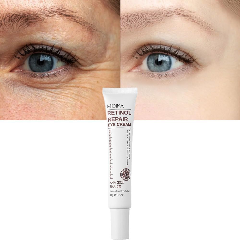 Magic Retinol Eye Cream for Dark Circles Puffiness and Bags Under Eyes, Instant Results Firm Eye Tightener Anti Aging Under Eye Cream for Men Women, Reduce Fine Lines Wrinkles and Age Spots, 1.06 Oz