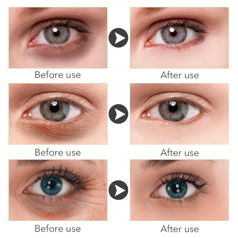 Magic Eye Cream for Dark Circles Puffiness Wrinkles Fine Lines and Bags Under Eyes, Quick Results Vitamin C Skin Renewing Anti Aging Eye Cream for Men Women All Skin Types (0.8 Oz)