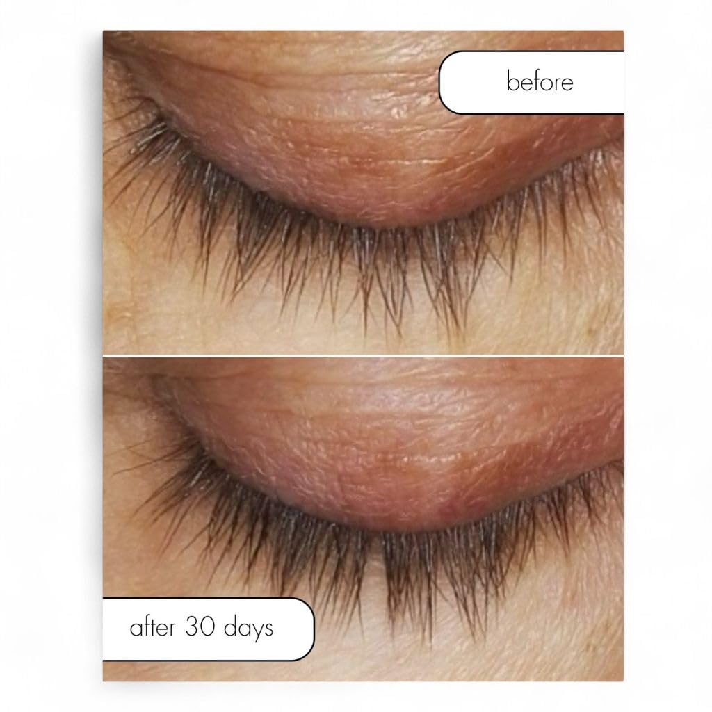 Serious Skincare Lash Bath & Conditioner - Double Action Eye Makeup Remover - Oil Free - Enhancing Peptides Promotes Eyelash Growth - Clover Flower - Effortlessly Removes Waterproof Mascara - 4 oz.