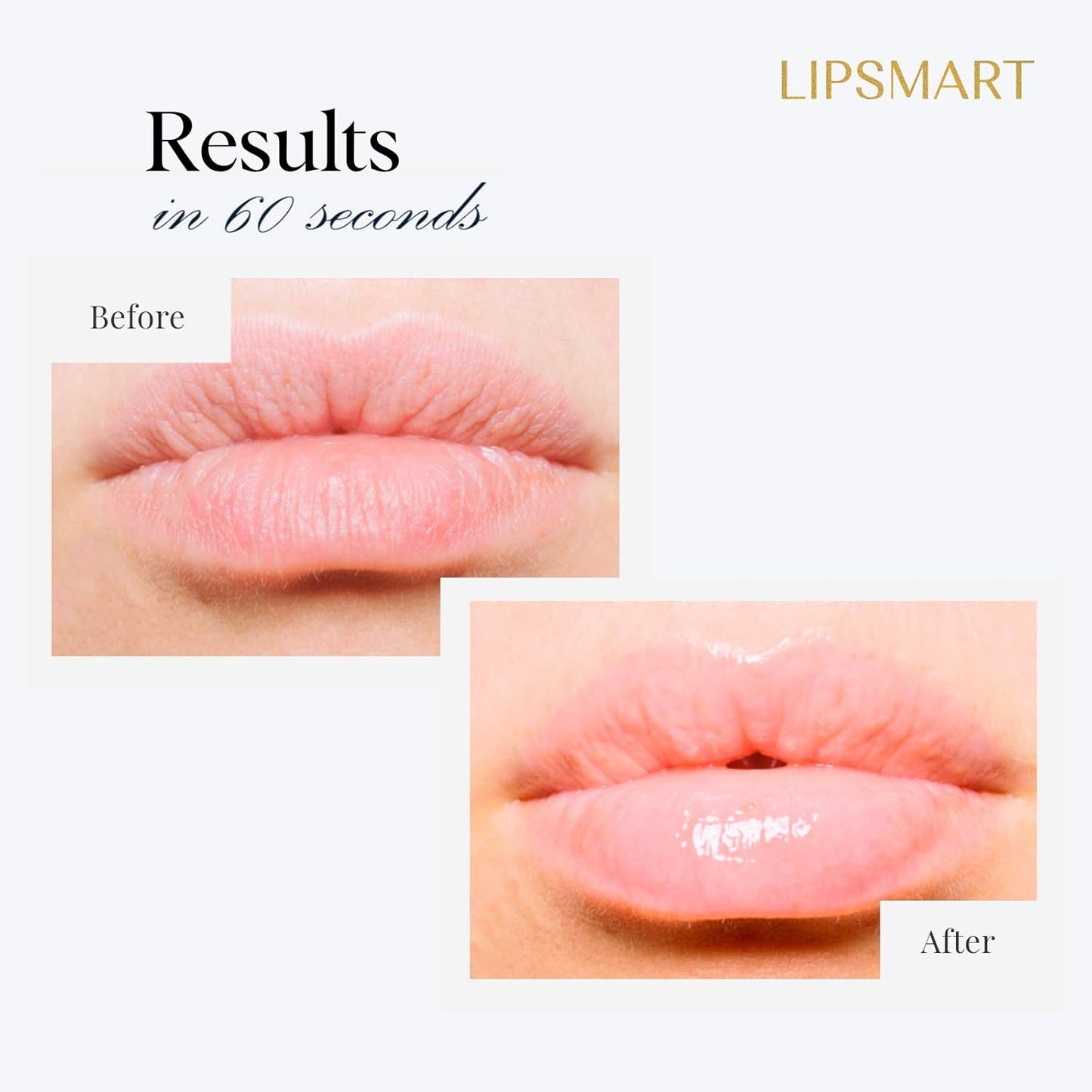 Ultra Hydrating Lip Treatment Moisturizer and Volumizer - Powerful Hydration for Dry Lips (3 Pack)
