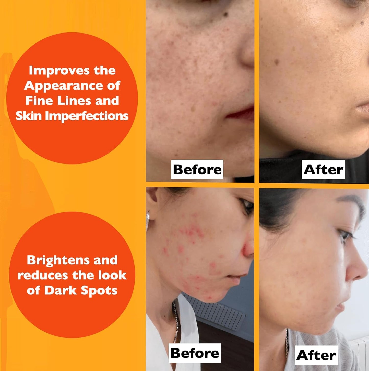 Vitamin C Serum For Face – Anti-Aging Facial Serum with Vitamin C, Hyaluronic Acid, Niacinamide, B5 & Vit E. Brightening Facial Essence for Dark Spots, Fine Lines, Wrinkles & Glowing Skin, 2 Fl Oz