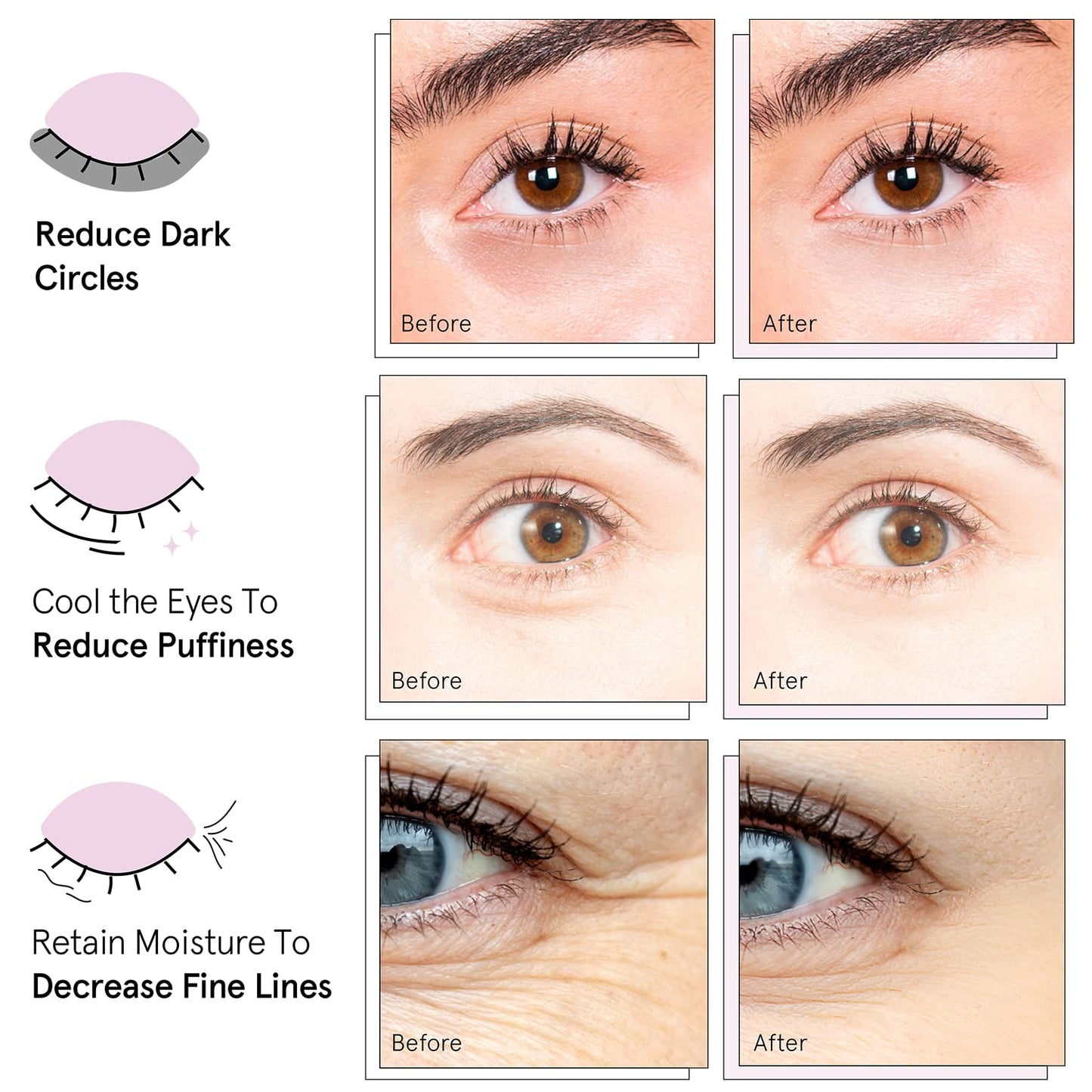 grace & stella Award Winning Under Eye Mask (Pink, 48 Pairs) Reduce Dark Circles, Puffy Eyes, Undereye Bags, Wrinkles - Gel Under Eye Patches - Gifts for Girlfriend - Vegan Cruelty-Free Self Care