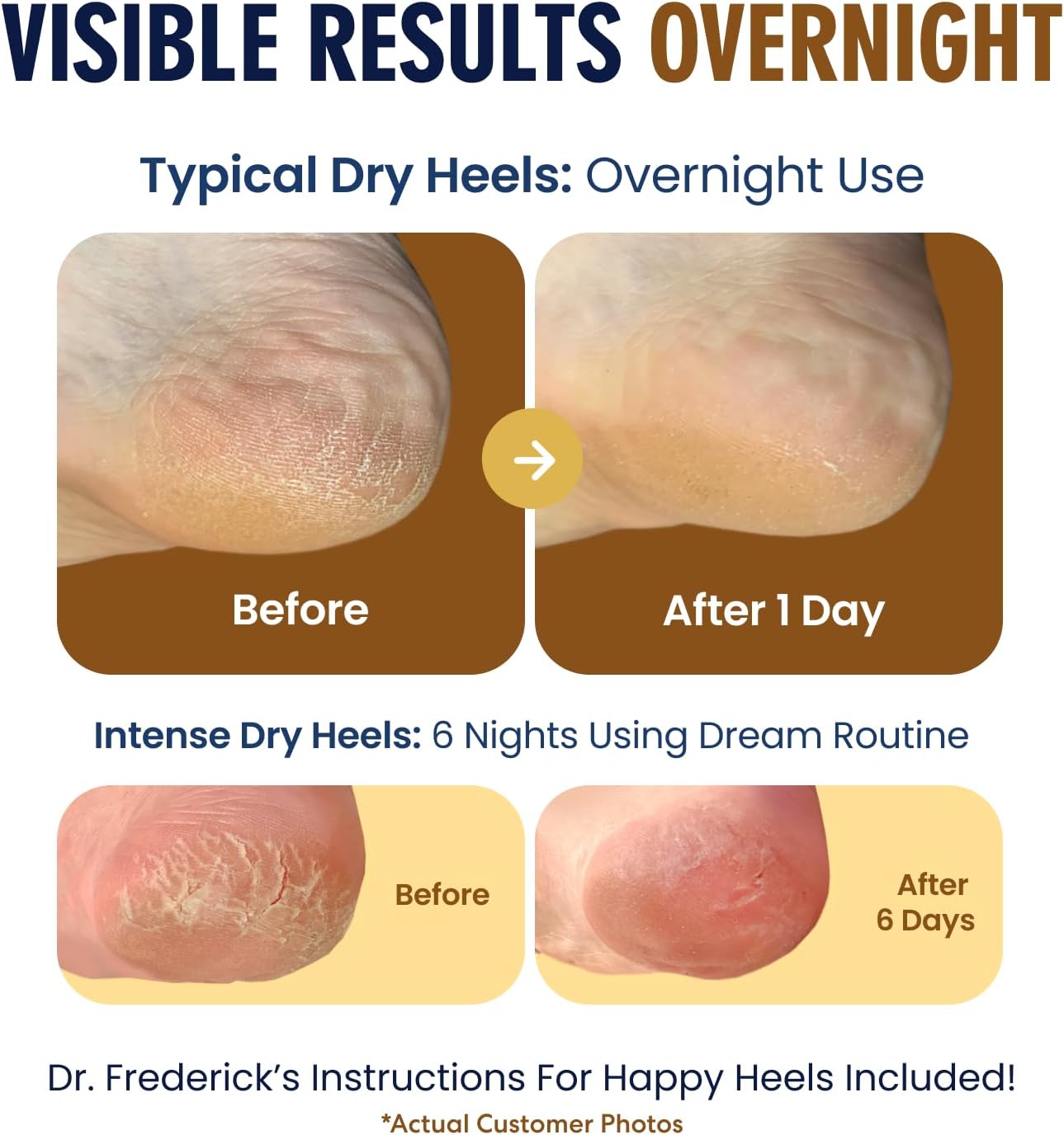 Dr. Frederick's Original Moisturizing Fuzzy Heel Socks - 2 Pairs - Cozy Gel-Lined Sleep Socks for Women & Men - Soothes Dry, Cracked Feet - Heel Repair - Citrus Glow