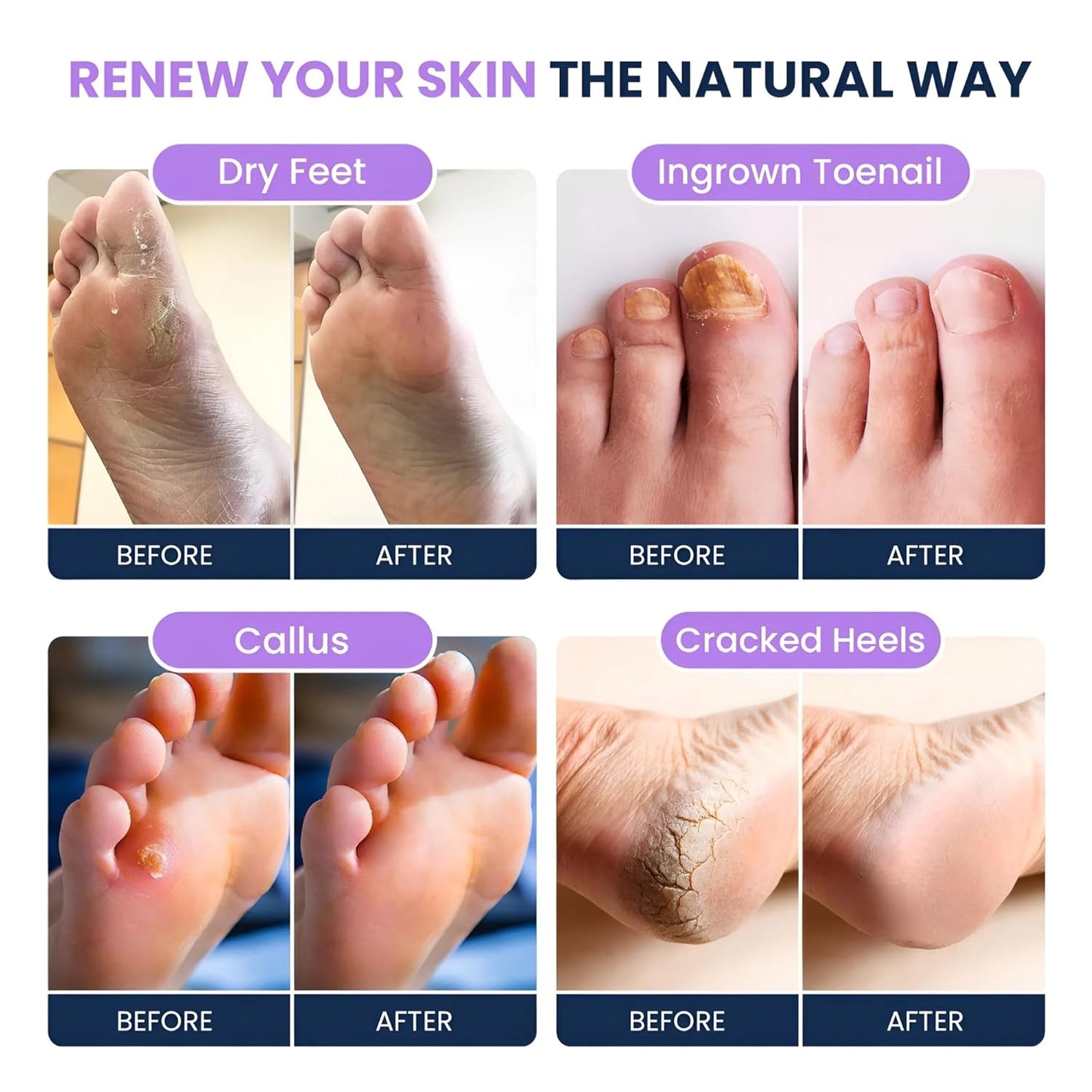 Soothing Lavender Foot Soak - Pedicure Foot Spa with Epson Salts for Soaking Feet - Foot Massager Spa - Foot Scrubber Dead Skin Remover - Epsom Salt Bath Soak