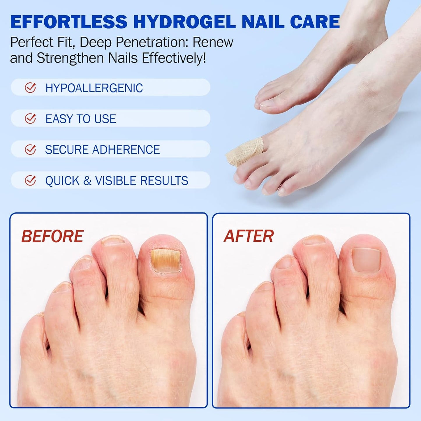 21 PCS Nail Patches ，Toenail Treatment Patch Extra Strength 8-Hour ，Nail Repair Patches,Nail Repair for Restores Damaged Nails and Appearance of Discolored，Overnight Renewal for Men and Women
