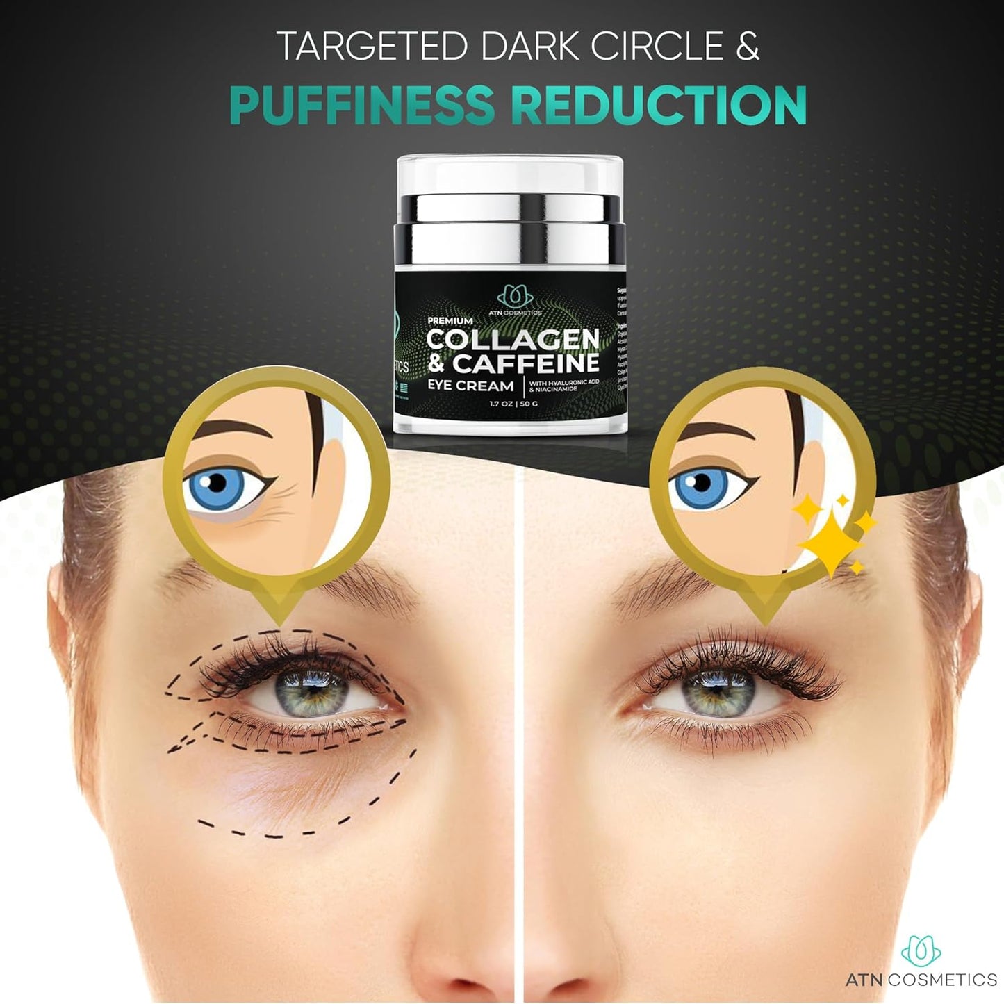 Collagen Eye Cream for dark circles, Eye Cream with caffeine, For Crows Feet & Dark Circles, and Puffiness, Infused with Hyaluronic Acid & Niacinamide, 1.7 OZ / 50 G