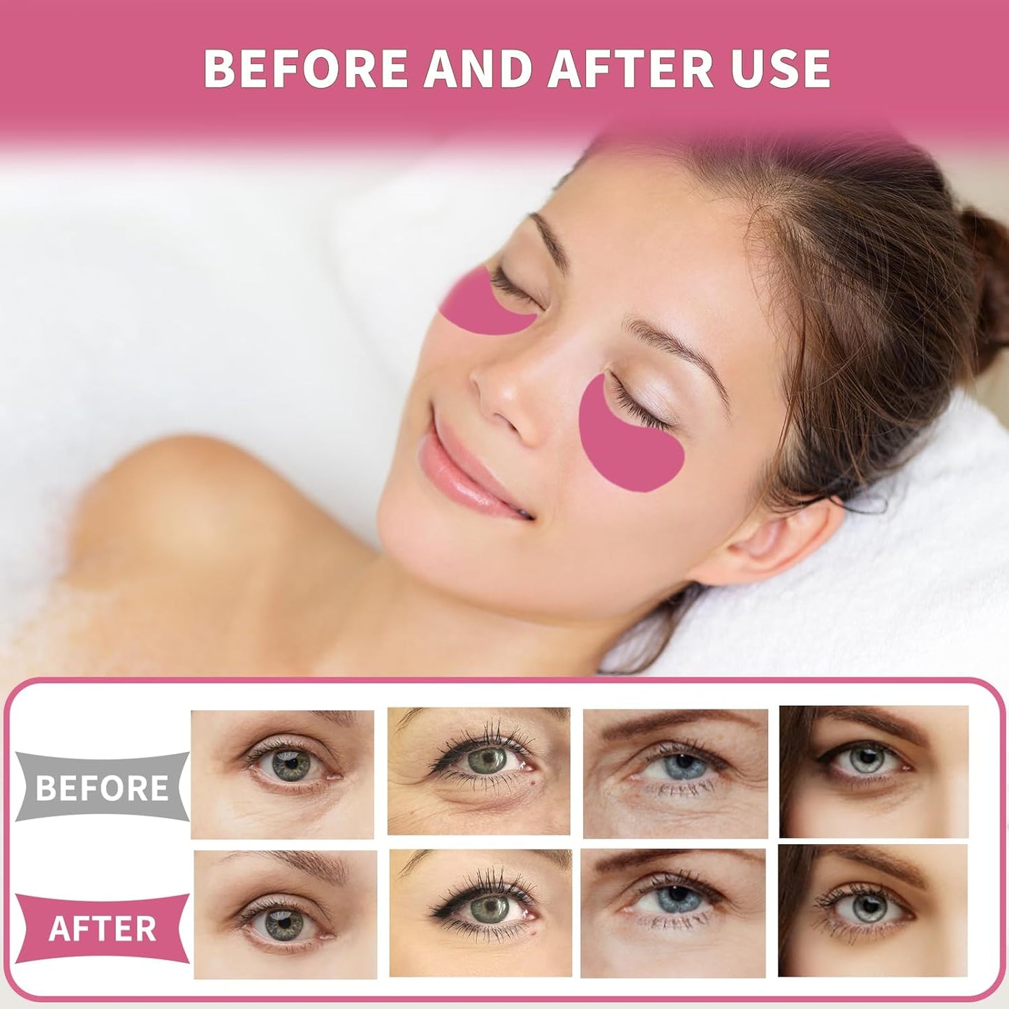 Under Eye Patches 70PCS, Peach Caviar Eye Patches for Puffy Eyes Treatment, Under Eye Masks for Dark Circles and Puffiness, Non-Irritating Eye Mask Patches Skincare, Eyes Bags Treatment, Eye Gel Pads