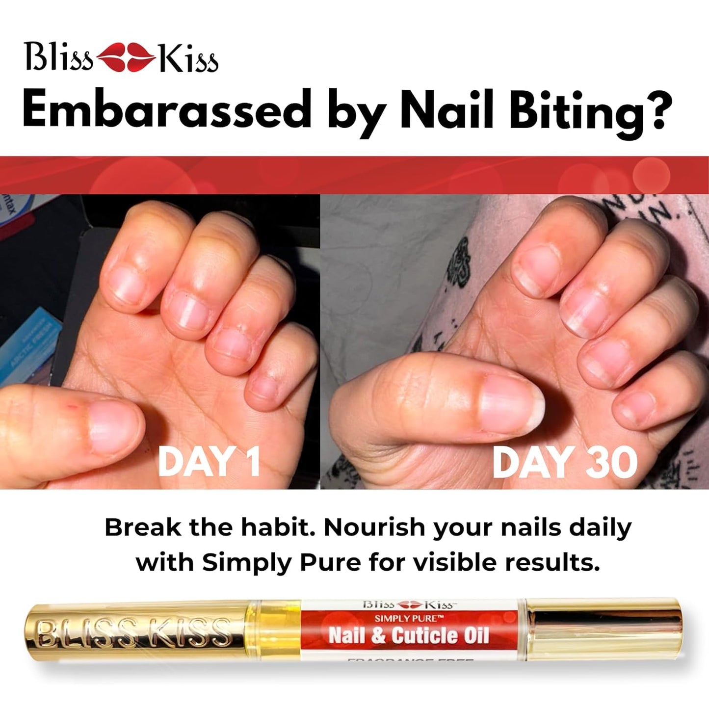 Bliss Kiss | 1 Fragrance Free | Nail Oil Cuticle Pen w/Vitamin E & Jojoba⏤Nail Strengthener Nail Growth Serum for Brittle Peeling Breaking Thin Nails