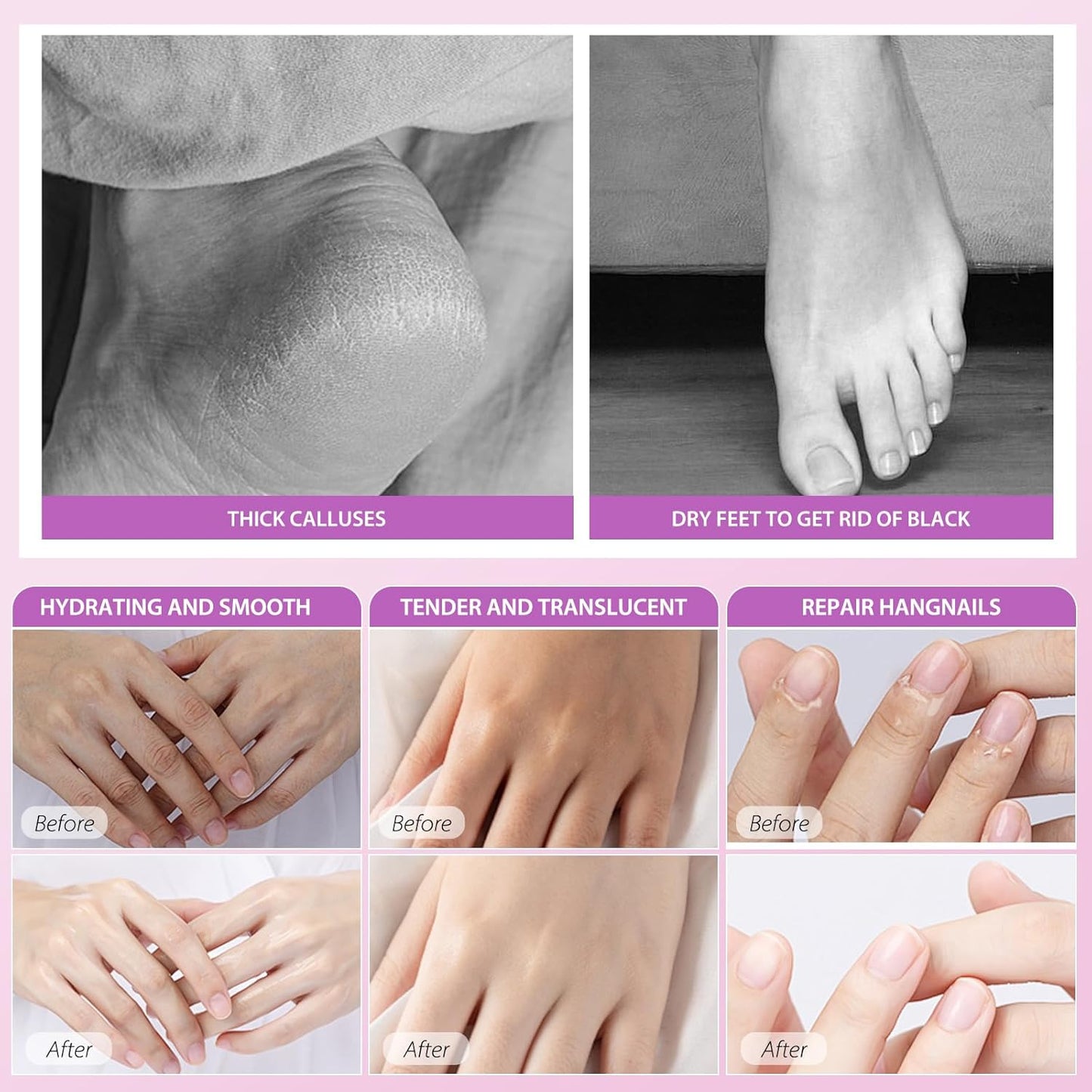 Hydrating Hand Foot Masks Set,5 Pack Glove Mask for Dry Hand,Exofliating 5 Pack Socks Maskfor Peeling Away Dead Skin Calluses（Lavender）