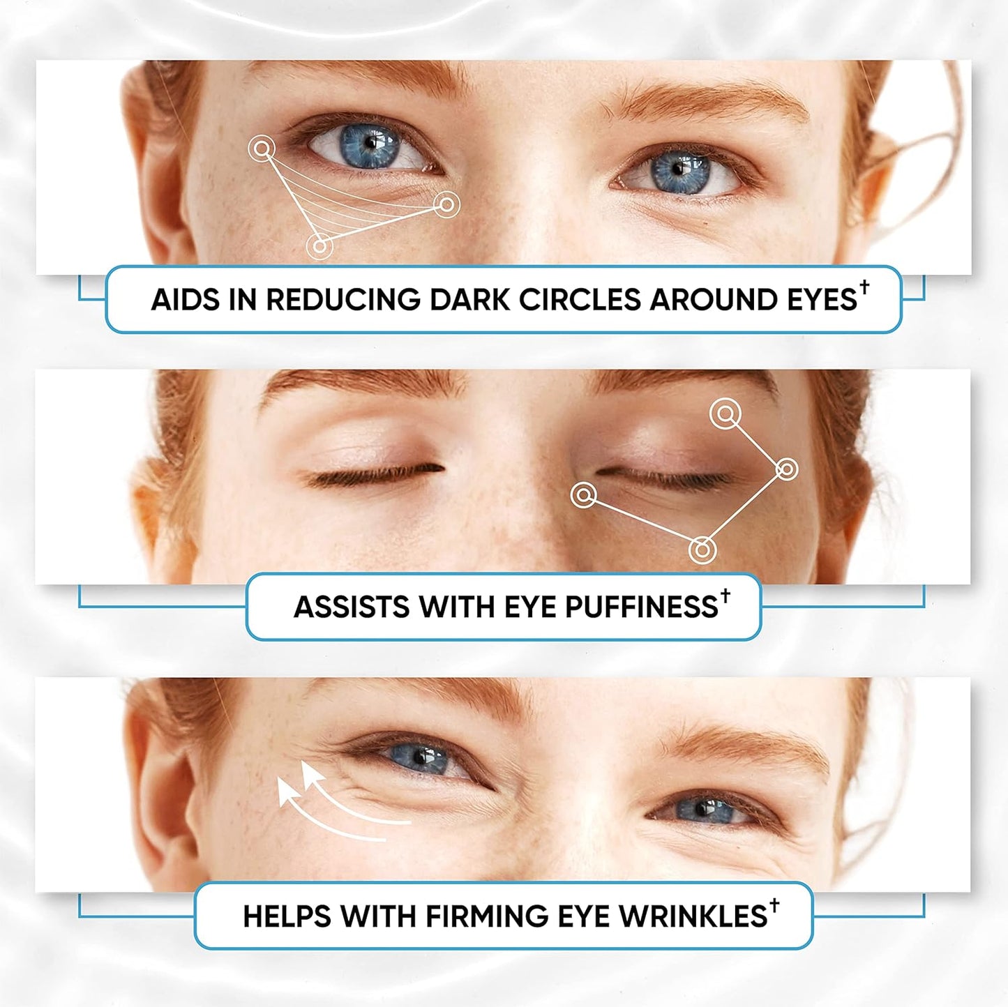 Under Eye Patches for Puffy Eyes, Dark Circles, Dull Skin - Natural Moisturizing Support - Help with Wrinkles and Fine Lines - Under Eye Mask with Hyaluronic Acid, Collagen, Caffeine - 30 Pairs