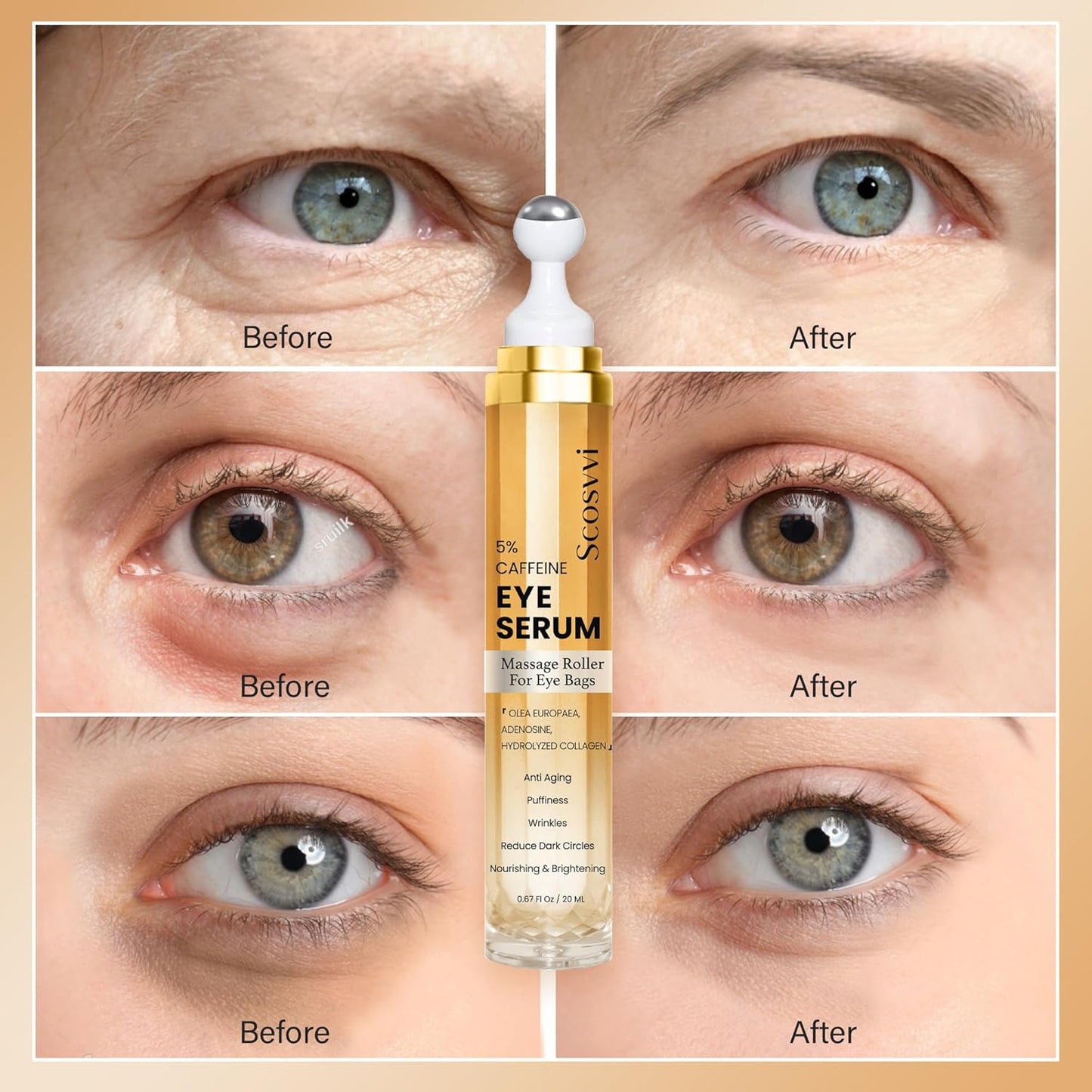 Caffeine Eye Serum for Dark Circles, Anti Aging, Puffiness & Fine Lines With Ice Roller for Puffy Eyes & Under Eye Bags, Eye Skin Care For Women & Men