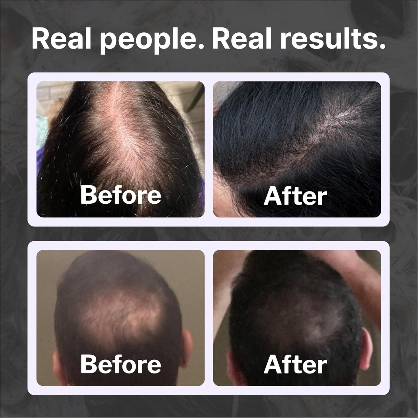 Shapiro MD Hair Growth Experts Hair Loss Shampoo | DHT Fighting Vegan Formula for Thinning Hair Developed by Dermatologists | Experience Healthier, Fuller and Thicker Looking Hair | 2 Month Supply