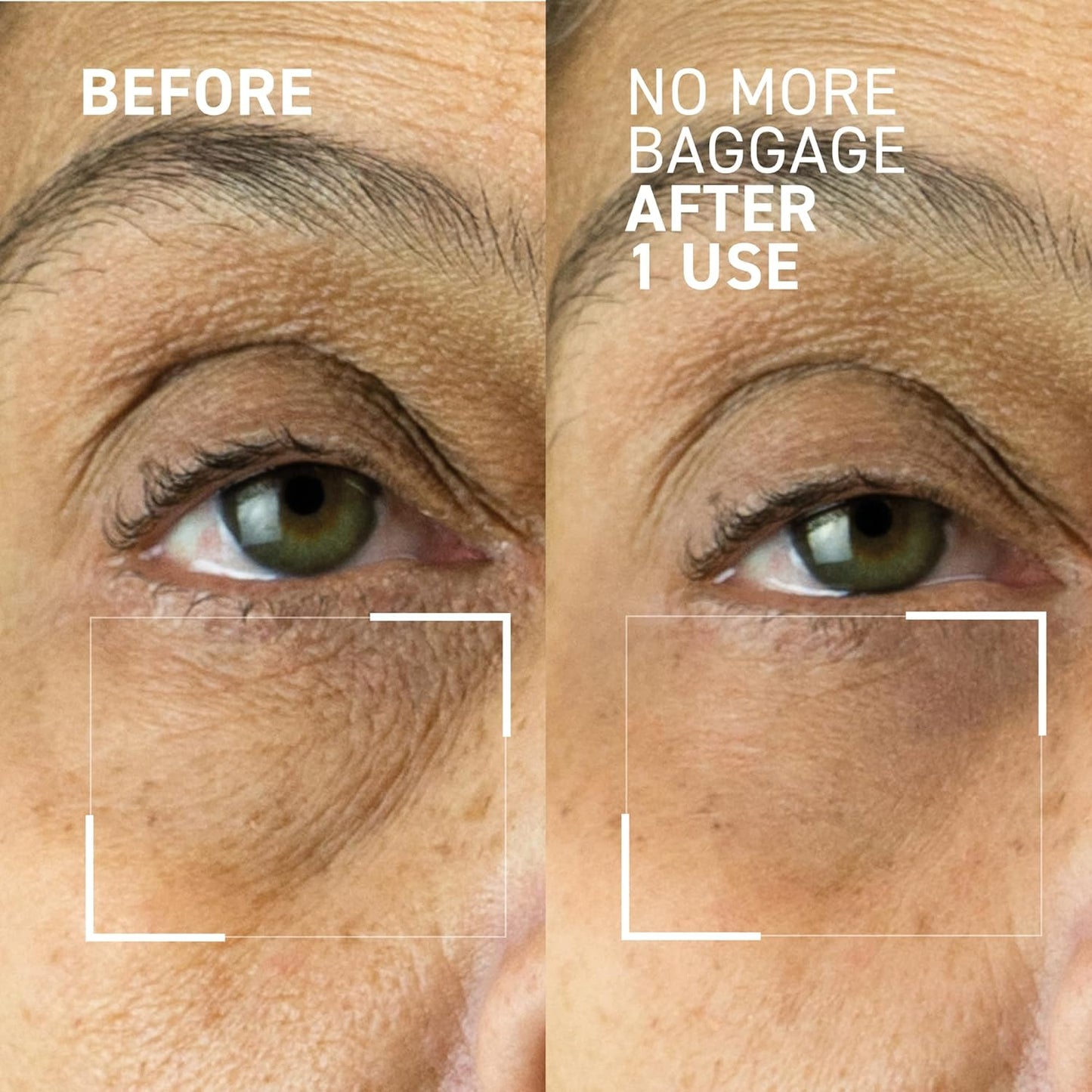 Dr. Brandt Needles No More Baggage - De-Puffs Under-Eye Bags and Brightens Dark Circles - Full (0.5 oz) + Travel Size (0.25 oz)
