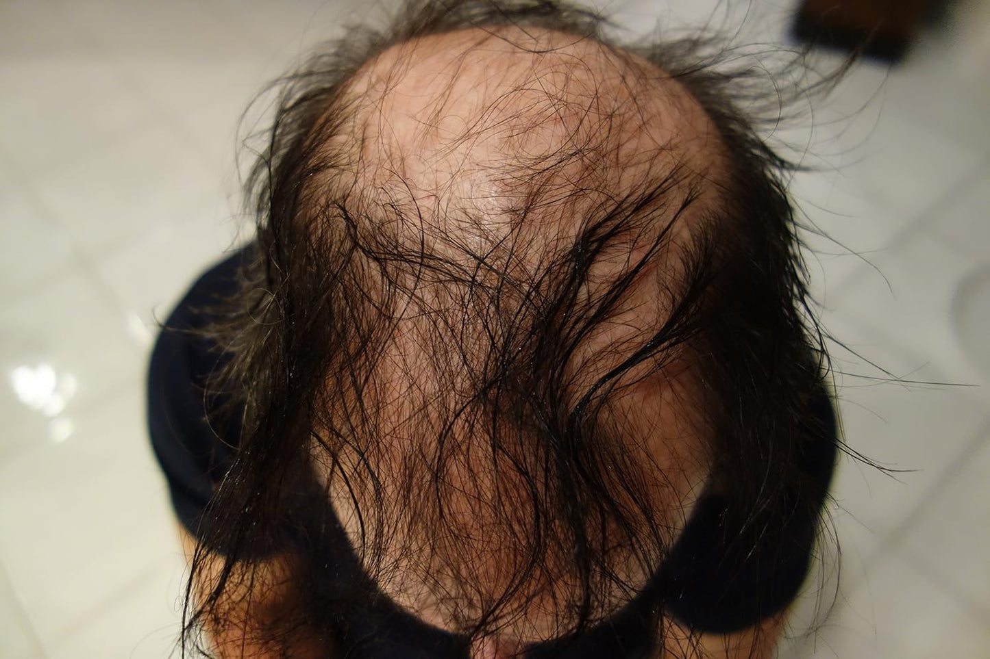 New Hair Building Fibers 100+14=114 Grams. Highest Grade Refill That You Can Use for Your Bottles From Competitors Like Toppik, Xfusion, Eclipse (Dark Brown w/reddish hue) SEE PIC OF DARK BROWN SHADES